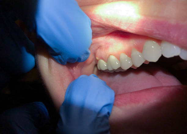 Best Pediatric Emergency Dentist in Bowmansville, PA
