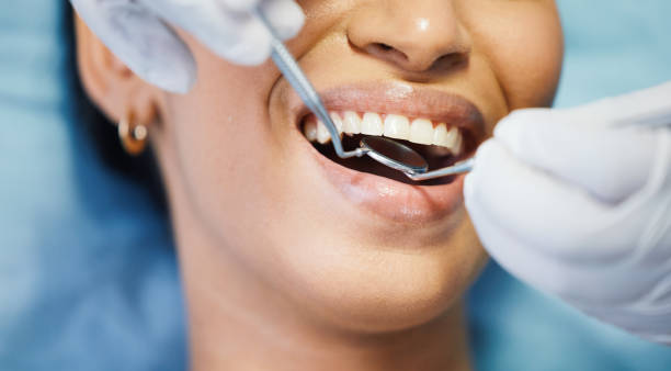 Best Emergency Treatment for Dental Infections or Abscesses in Bowmansville, PA