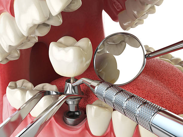 Best Emergency Gum Treatment in Bowmansville, PA
