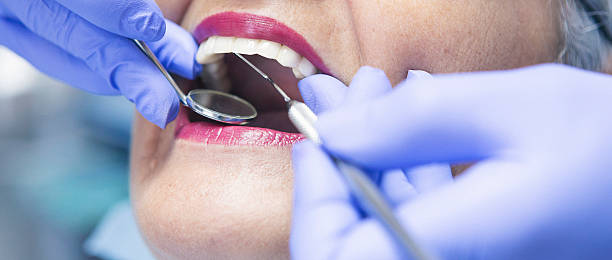 Best Emergency Wisdom Teeth Removal in Bowmansville, PA